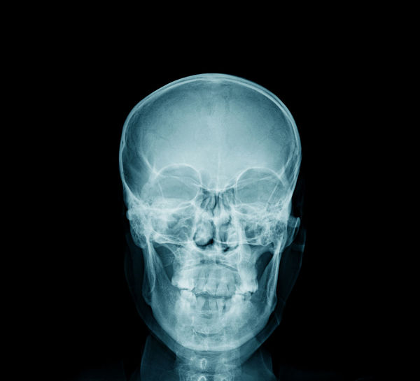 Close-up of medical x-ray against black background