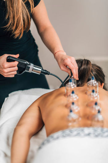 Cupping therapy, hijama. female therapist using vacuum gun for cupping therapy