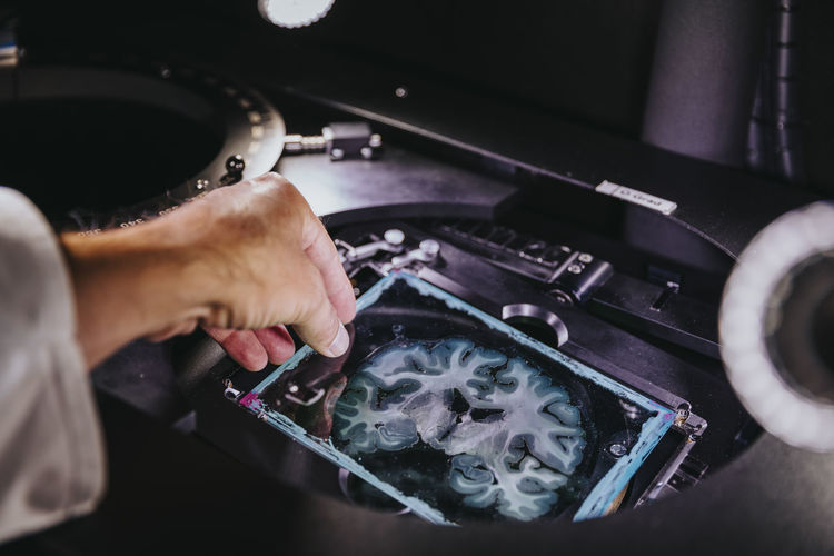 Close-up of scientist hand removing human brain slide from microscope at laboratory