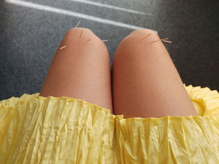 Midsection of woman with acupuncture needles on leg 