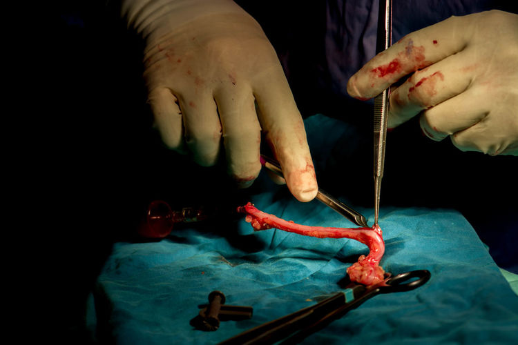 Midsection of surgeon holding work tools on table in operating room