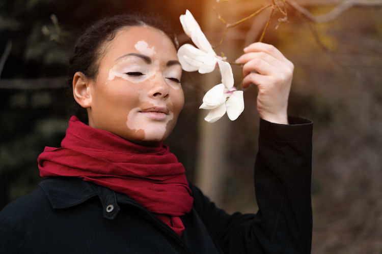 Close-up of young woman with vitiligo holding flowers standing in park