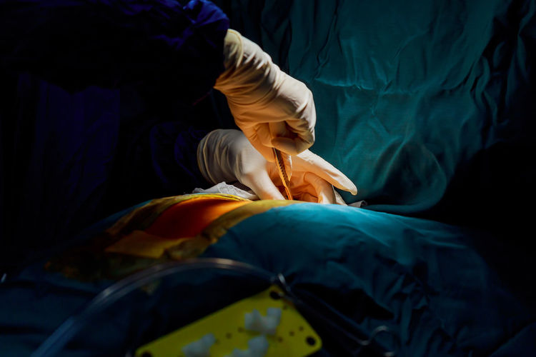 Cropped hands of surgeon doing surgery in operating room