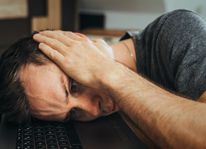 Man lies stressed in home office with head on laptop and has burnout due to high workload at work