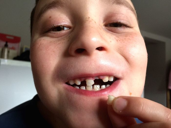 Close-up portrait of boy with broken tooth at home