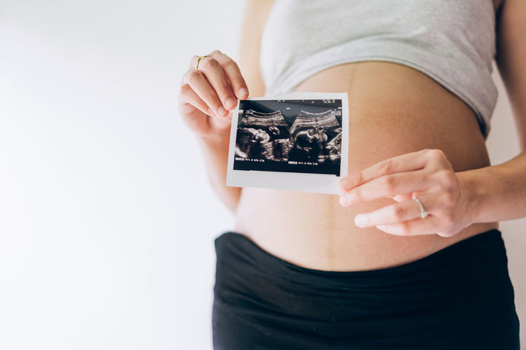 Midsection of pregnant woman holding x ray