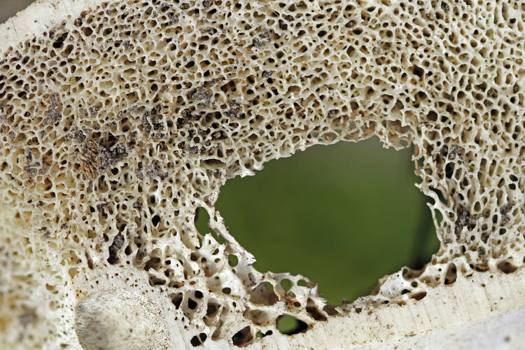 Detail shot of hole