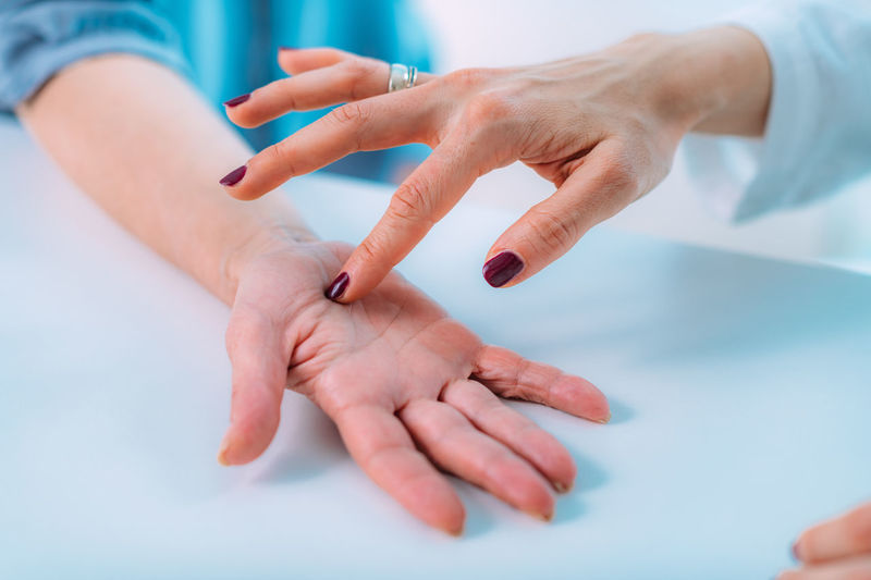 Examining the hand of a senior patient with carpal tunnel syndrome
