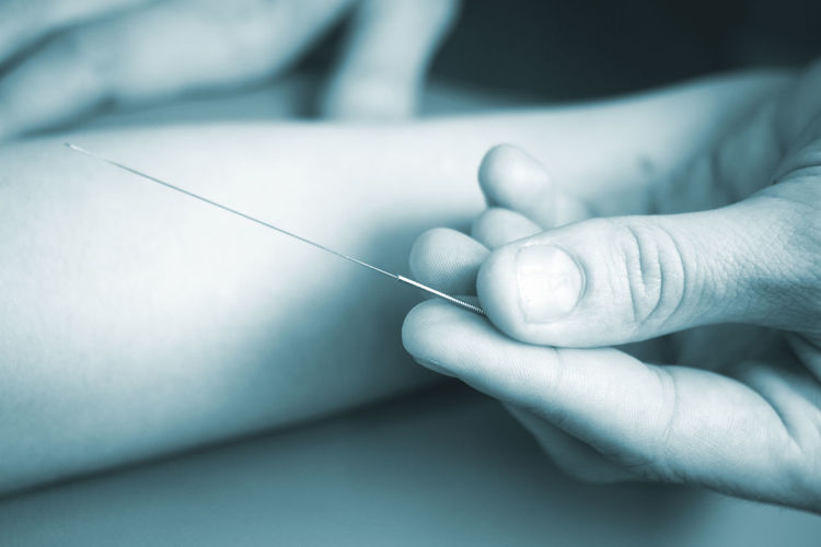 Cropped hand of doctor holding acupuncture needle in hospital
