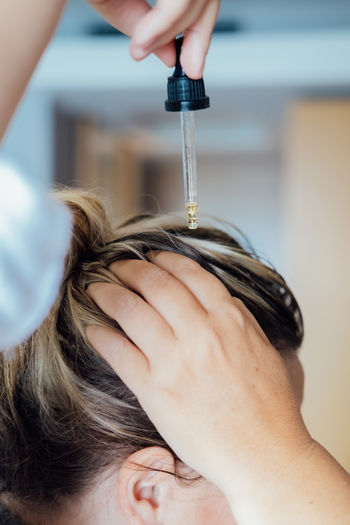 Woman applies oil to her hair with pipette. beauty caring for scalp and hair.