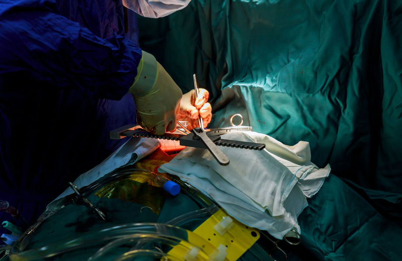 Cropped hands of doctor operating patient in hospital