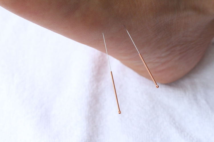Close-up of acupuncture needle in human leg on bed