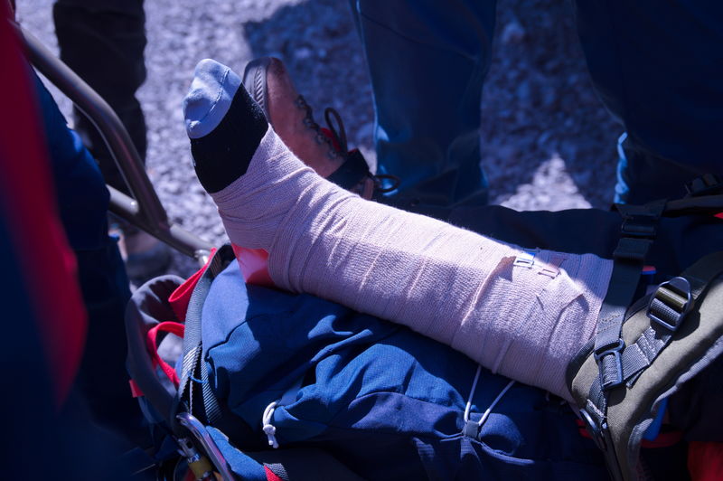 Mountain rescue service provide first aid to person with broken leg