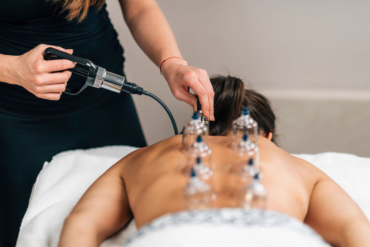 Cupping therapy on women's back