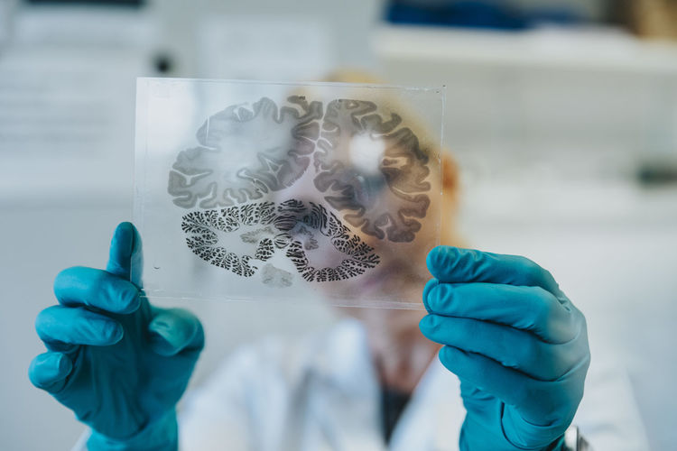 Scientist holding human brain microscope slide while standing at laboratory