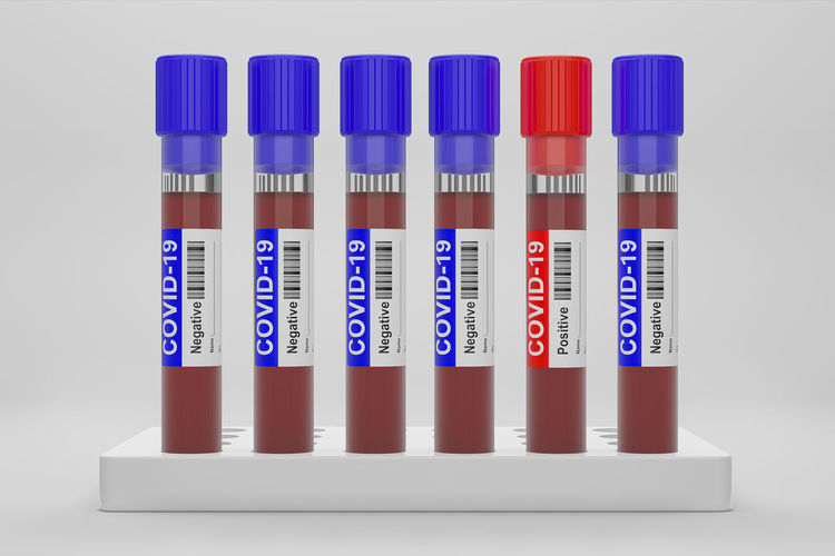 Close-up of blood samples against white background
