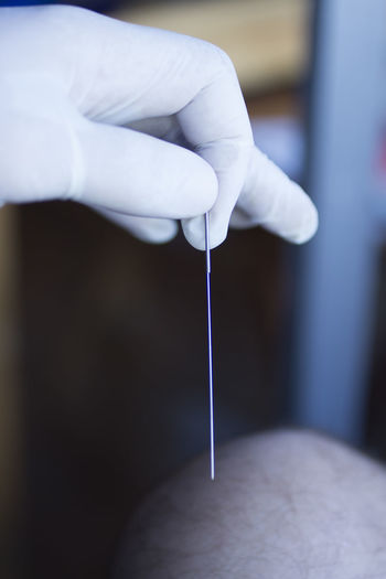 Close-up of hand holding acupuncture needle 