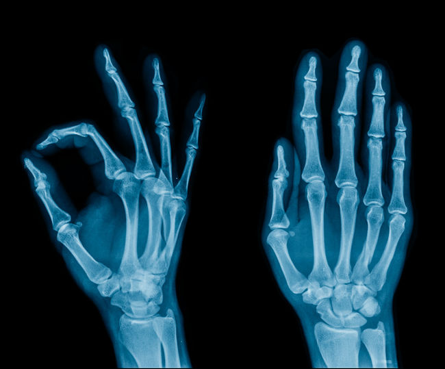Full frame shot of x-ray