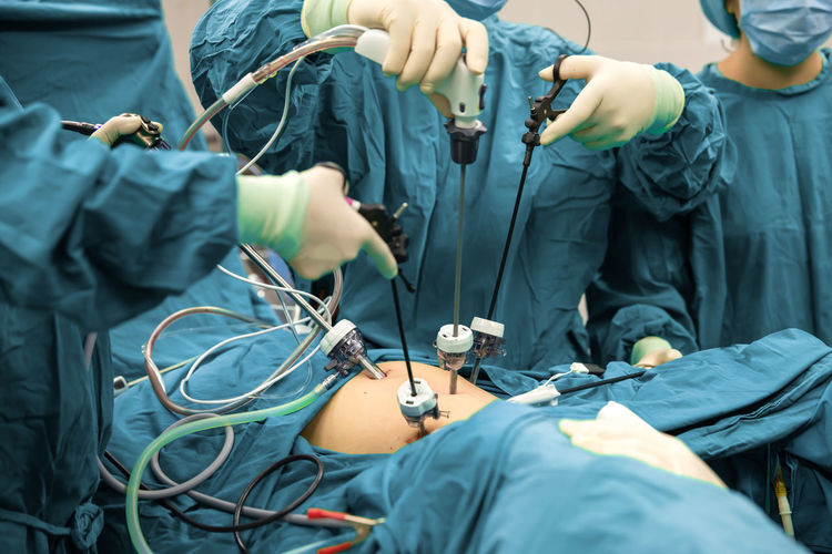 Surgeons team hands during laparoscopic abdominal operation in patient surgery in operating room