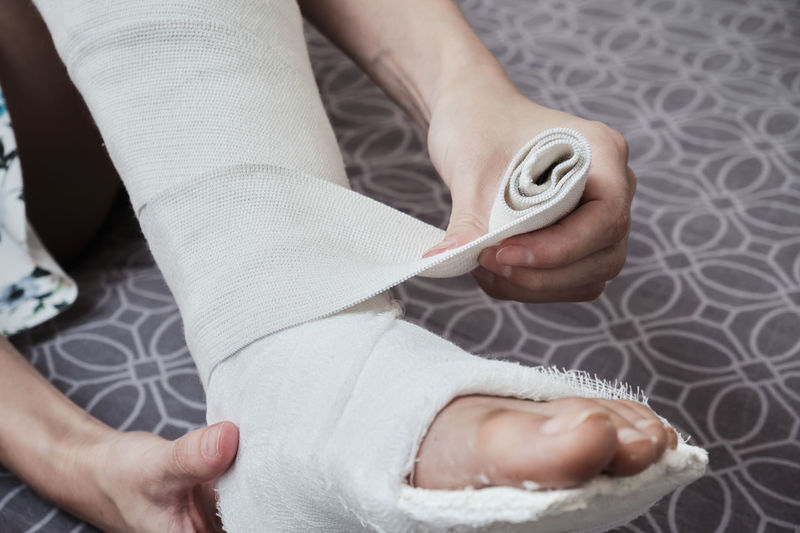 Applying an elastic bandage to a broken leg. the leg is in a plaster cast. 