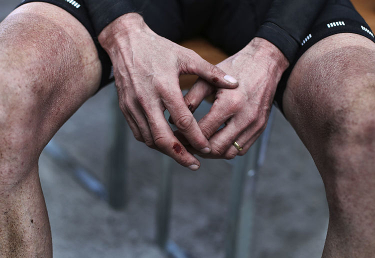 Midsection of injured male cyclist sitting on chair outdoors