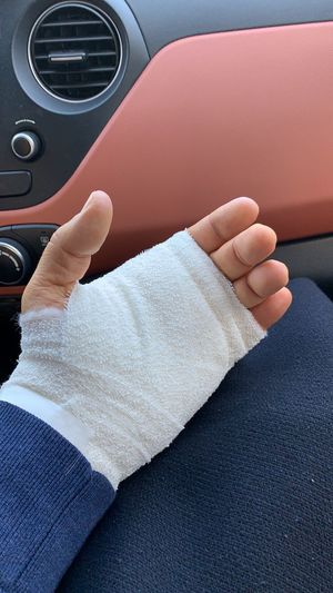 Cropped hand with bandage in car